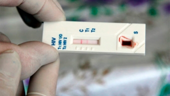 Toma de Test Rápido de VIH Registra Una Fuerte Baja Producto de la Pandemia Por Covid-19