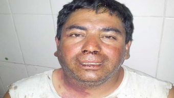 Denuncian Golpiza a Dirigente Sindical de Parte de Carabineros