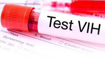 Testeos de VIH Disminuyen un 44% Durante la Pandemia