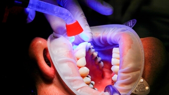 Problemas Odontológicos, la Nueva Enfermedad Crónica en Chile