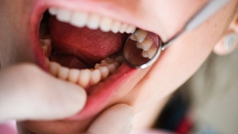 El 62% de Los Chilenos Considera Que su Salud Bucal es Regular, Mala o Muy Mala