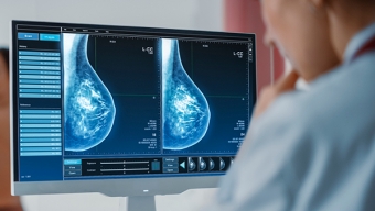 Muertes Por Cáncer de Mama Aumentan un 70% en la Región